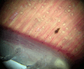 First gill arch of commercial trout exposed to Irfon mussels showing encysted glochidia.